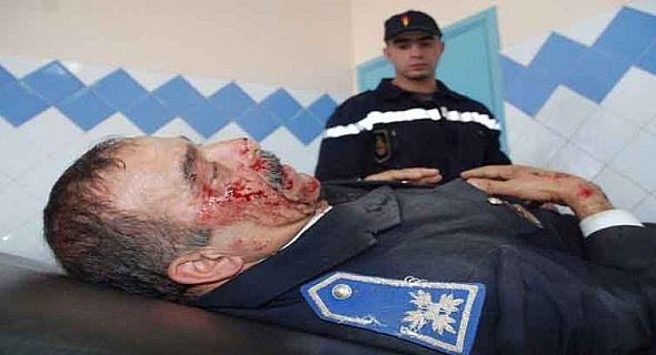 سيدي إفني‎ : انقلاب سيارة للشرطة يخلف اصابة شرطيان !
