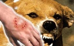 كلب مسعور يهاجم 9 اشخاص ويزرع الرعب في دوار العوينة جماعة اكلو