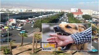 انزكان ايت ملول ... كلب شرس يرسل أطفالاً في حالة حرجة إلى المستعجلات