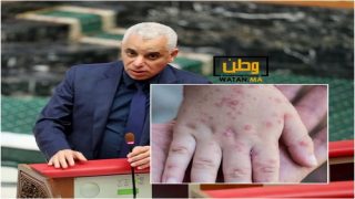 وزارة الصحة ...بوحمرون يعود إلى الإنتشار في المغرب بتسجيل وفيات