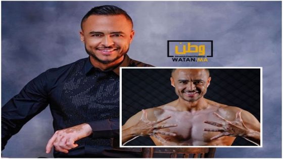 الإعلامي هشام مسرار يتحدى "البرص" ويفاجئ متابعيه برسالة مؤثرة