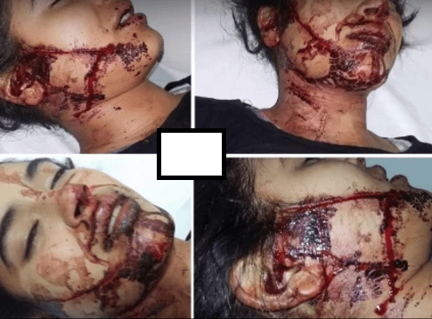 خطير : جزار يقطع لسان فتاة بسكين ويحول وجهها إلى شوارع من الدماء